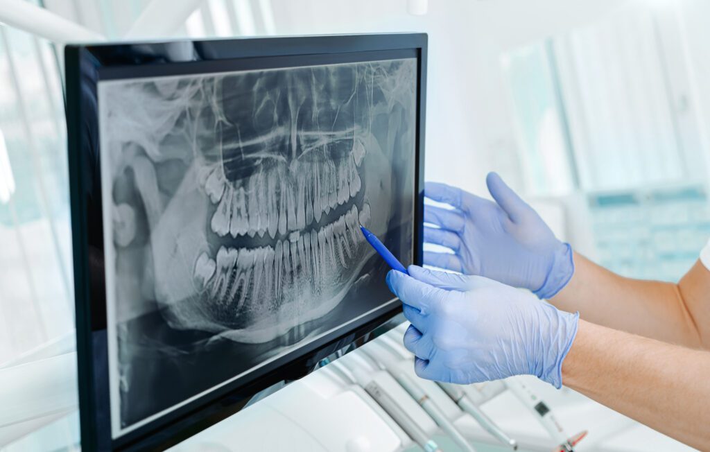 Fort Washington Orthodontics | Sally Gupton DDS -