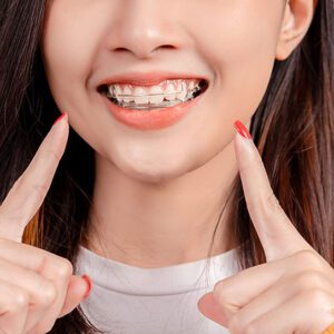 Fort Washington Orthodontics | Sally Gupton DDS -