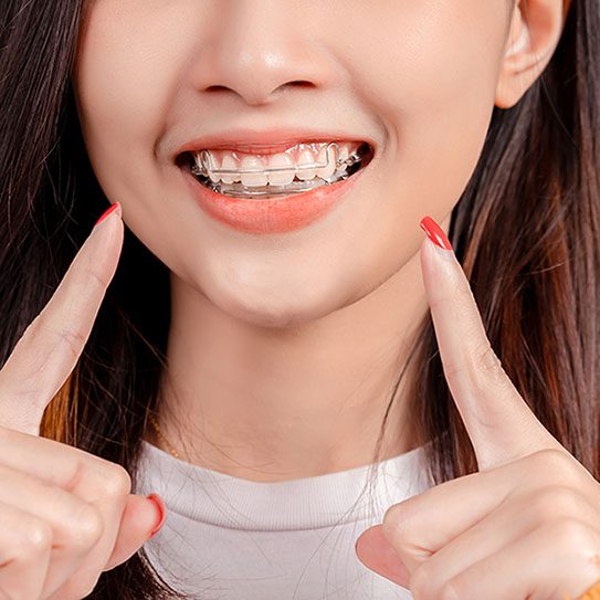 Fort Washington Orthodontics | Sally Gupton DDS -